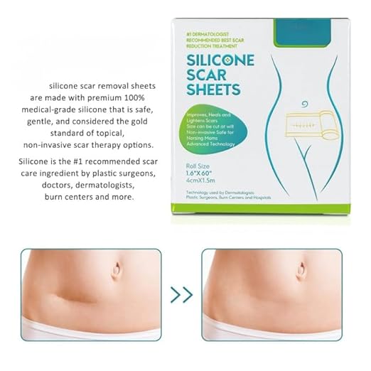 Silicone Scar Sheets, Silicon gel sheets for Scars Transparent Medical Silicone Gel Tape