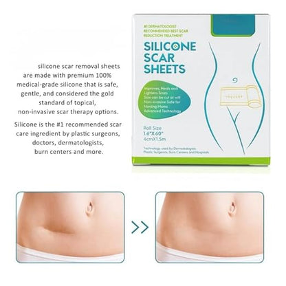 Silicone Scar Sheets, Silicon gel sheets for Scars Transparent Medical Silicone Gel Tape