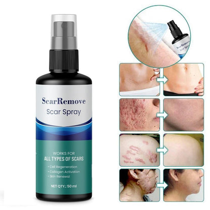 Dermatologically Tested, Scar Removal Spray 50ml (Pack Of 2 bottles)